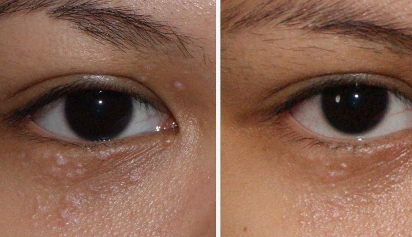 Before & After